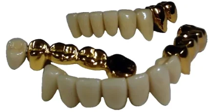 Зубные цельнолитые протезы