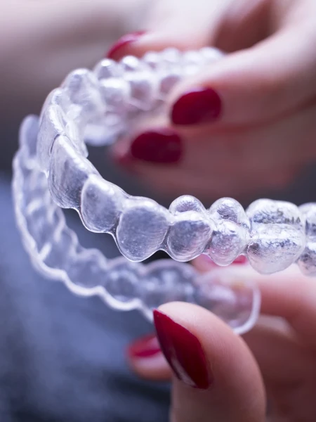 Ортодонтическое лечение прозрачными капами