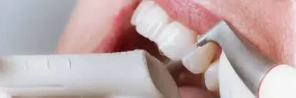 Профессиональная гигиена полости рта и зубов методом Air Flow («Эйр Флоу»).
