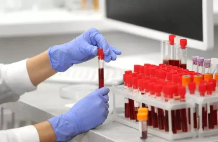 Анализ крови на вирус гепатита С: количественное определение РНК вируса и генотипирование