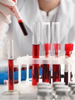 Анализ на антитела модифицированному цитруллинированному виментину (МЦВ) IgG