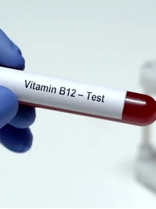 Анализ крови на фолиевую кислоту, витамин В9 количественно, ИХЛА, витамин В12 цианокобаламин, ИХЛА