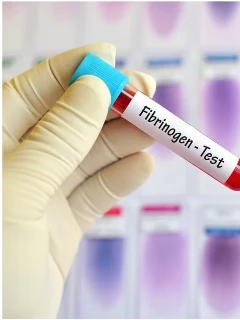 Анализ крови на фибриноген