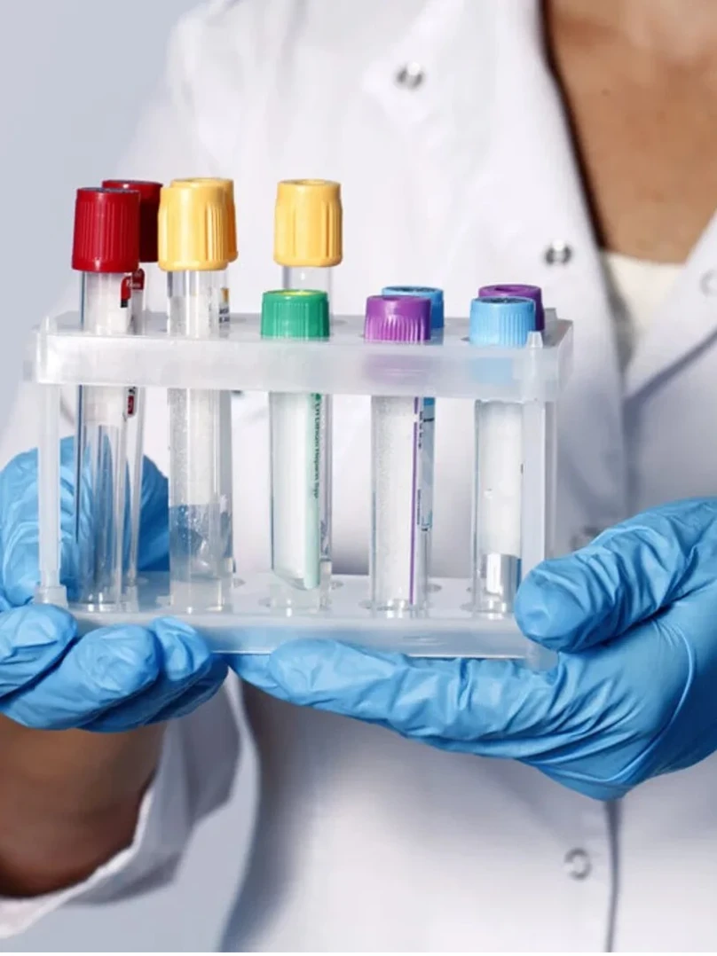 Анаоиз на рак прямой кишки, поджелудочной железы, толстого кишечника СА 242 ИФА